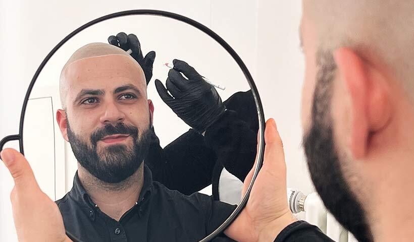 Patient begutachtet seinen Oberkopf im Spiegel während er eine Beratung von der Spezialistin erhält
